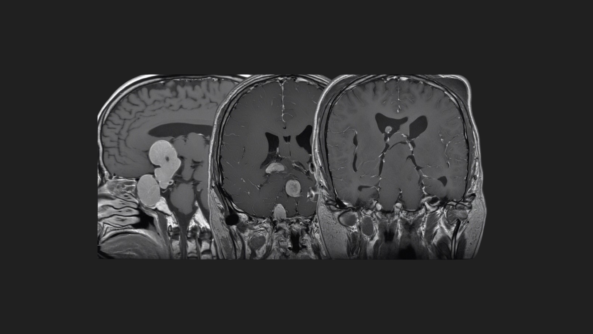 Synthetic Brain Dataset